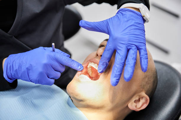 Best Dentist for Tooth Abscess  in Benton, TN